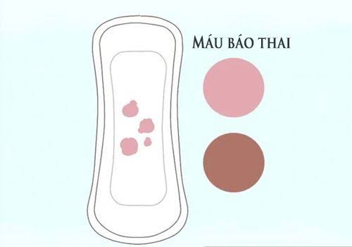Khong phai ai mang thai cung co mau bao thai, nhieu nguoi khong xuat hien hien tuong nay nhung thai van phat trien binh thuong