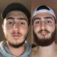 Discussion of beard oil and other beard care products, including their uses, application, benefit, diy creations and more! How To Use Beard Balm Reddit Arxiusarquitectura