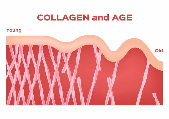 Structural shift in collagen fibers from youthful skin to mature skin, AI generated