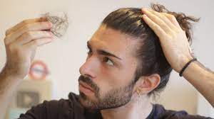 Hair is made of protein strands. How Much Hair Loss Per Day Is Normal Youtube