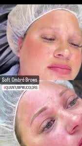 ✨ Xeomin vs. Botox vs. Dysport: Which is Right for You? ✨ ASK FOR OUR  SPECIALS In Austin, we're all about looking our best! But which neurotoxin  should you choose for smoother