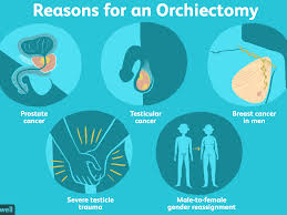 Be aware of any dull soreness or heaviness. Everything You Need To Know About An Orchiectomy