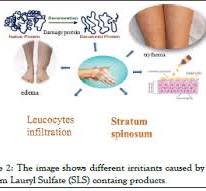 The Study of Sodium Lauryl Sulfate (SLS) Toxicity