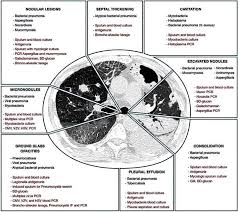 See more of legionella on facebook. Syrad Startseite Facebook