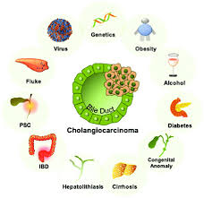 Check spelling or type a new query. Established Risk Factors Of Cholangiocarcinoma Psc Primary Sclerosing Download Scientific Diagram