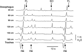 Camels are animals with a history. Chewing Activities And Oesophageal Motility During Feed Intake Rumination And Eructation In Camels Springerlink