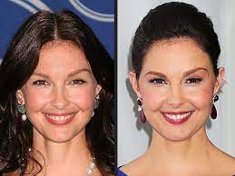 Hopefully, sometime soon, down the road, … Ashley Judd Blames Steroids For Her Puffy Face People Com