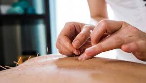 Maryland university of integrative health bridges ancient wisdom & contemporary science to educate and train the best integrative healthcare practitioners. Acupuncture Johns Hopkins Medicine