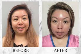 KYOR OUTGLOW Radiance Tri-Factor™ Jelly Reviews