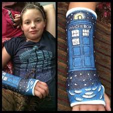 Nikki A On Instagram Voila Finished Decorating Her Cast Doctorwho Whovian Brokenarm Castart Cast Tardis Blue Ar Arm Cast Tardis Art Cast Decoration