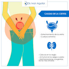Resultado de imagen de causas de la cistitis
