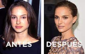 Famosas con cara redonda se han sometido a este procedimiento. Descubre Los Cuidados Seguidamente De Una Bichectomia Cuidados Despues De Un Bichectomia