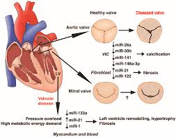 Ijms Free Full Text Micrornas In Valvular Heart Diseases Potential Role As Markers And Actors Of Valvular And Cardiac Remodeling Html