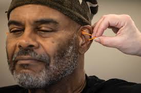 Acupuncture has been used for decades to treat addiction — advocates want  to expand its reach
