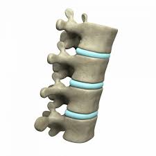 It is when you develop neck pain and stiffness with spasm of the surrounding neck. Facet Joint Sprain A Pain In The Back Sports Spinal Albury