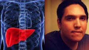 Check spelling or type a new query. Kenali Ciri Ciri Penyakit Liver Mulai Kulit Berubah Kuning Sampai Mudah Lelah Tribun Kaltim