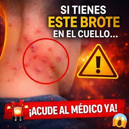 Conoces los principales tipos de erupciones en la piel? Descubre cuáles son  y qué las causa.👇