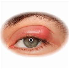 Image result for Blepharis bainesii