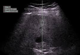 Lb ultrasonido, ciudad de méxico. Uso Y Liderazgo Del Ultrasonido En Radiologia