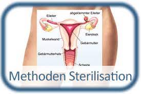 Schwanger Trotz Sterilisation