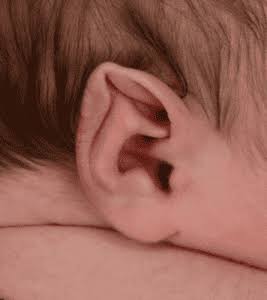 ما تشوهات صيوان الأذن الخِلقية؟