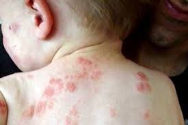 Bisikansehat Com Nbspthis Website Is For Sale Nbspbisikansehat Resources And Information Eksim Kesehatan Bayi Kesehatan Anak