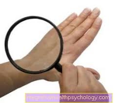 يعتبر مرض النقرس من الامراض التي تحتاج الى معرفة دقيقة لأسبابه واعراضه وكيفية علاجه بطرق طبيعية او الاعشاب والطب البديل. Ø£Ø¹Ø±Ø§Ø¶ Ù…Ø±Ø¶ Ø§Ù„Ø²Ù‡Ø±ÙŠ Ø§Ù„Ø·Ø¨ Ø§Ù„Ø¯Ø§Ø®Ù„ÙŠ