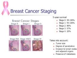 Image result for Inflammatory breast cancer