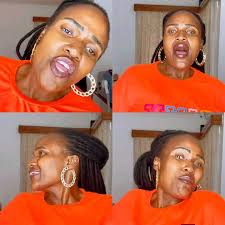 Sandra Dacha's new look after successful Ozempic procedure