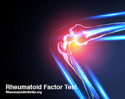 rf test what is the normal range for a rheumatoid factor