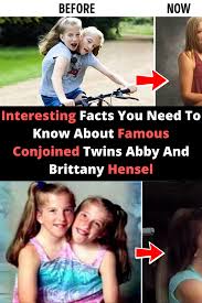 The two are conjoined twins who have been willing to talk about their condition publicly. Interesting Facts You Need To Know About Famous Conjoined Twins Abby And Brittany Hensel Funny Photos Humor Fun Facts