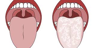 We did not find results for: What Your Tongue Appearance Means For Your Health Dr Axe