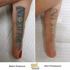 After A Few Touch Ups To This Finger Tattoo And A Failed Attempt To Cover It The Client Grew Tired Of The Constantl Finger Tattoos Finger Tattoos Fade Tattoos