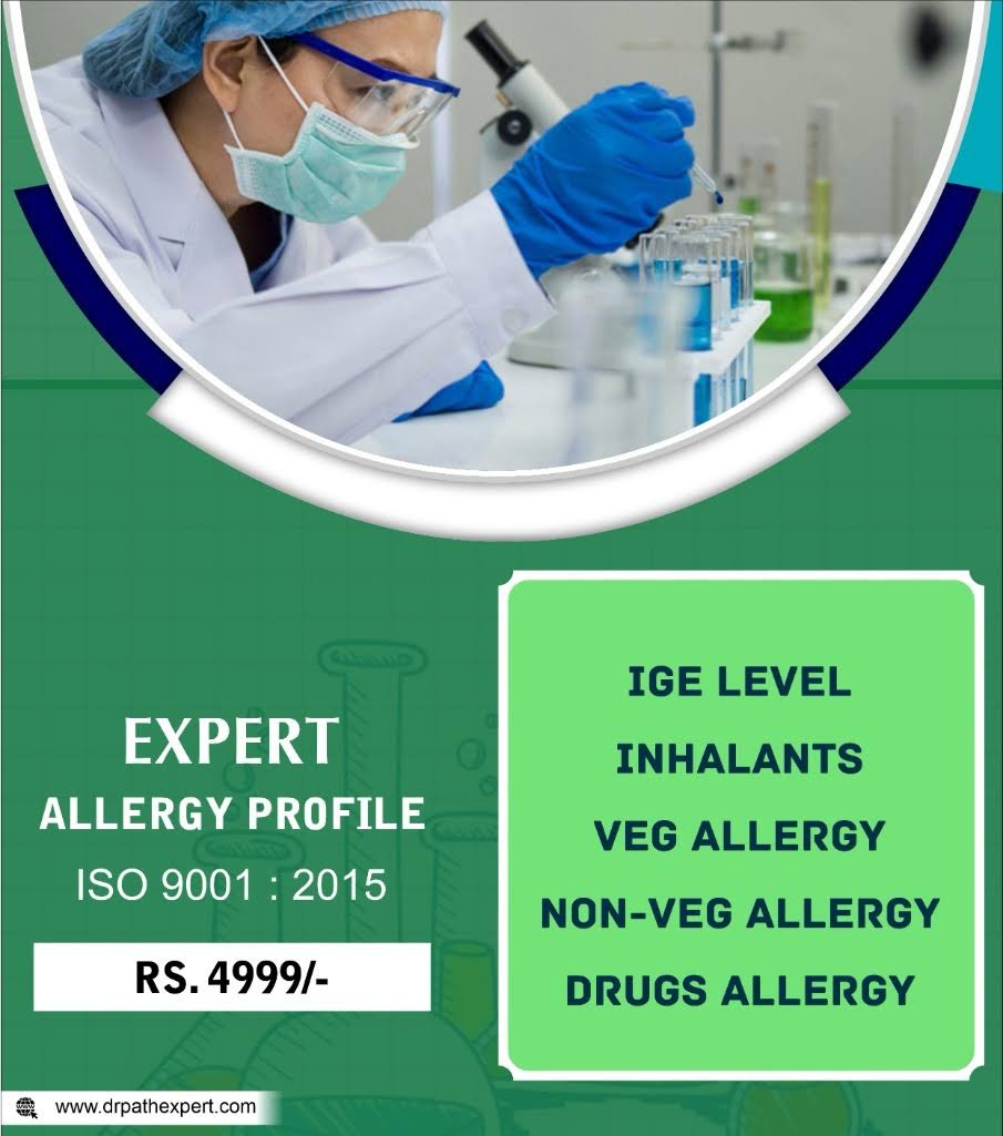 Complete Allergy Testing Blood Sample product image