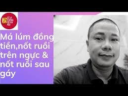 Má lúm đồng tiền, nốt ruồi trên ngực và nốt ruồi sau gáy là đại phú quý