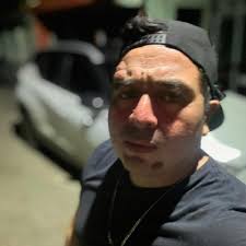 DR. JOSÉ D. MANRIQUE CRUZ CIRUJANO PLÁSTICO CERTIFICADO. CITAS AL (981) 146  46 61 y (981) 811 66 52 CLINICA UCPER