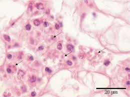 Image result for Bonamia