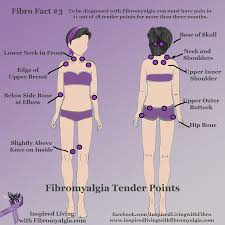 Fibromyalgia Tender Points Fibromyalgia Fibromyalgia