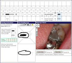 39 Detailed Dental Charting Practice Games