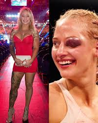 When Ebanie Bridges had a tough fight