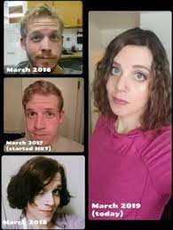 Harry benjamin entwickelte dagegen 1970 eine theorie, laut welcher der transsexualität grundsätzlich psychische ursachen zugrunde liegen. Vorher Nachher