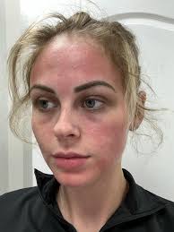 Holly Elizabeth Aesthetics