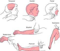 According to schaferselfdefence, a pressure point is an area on your body that when attached leads. Chigung