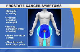 In which case it might mimic some of those symptoms of an obstructed or it's produced by the prostate gland and it's a marker for the presence of prostate cancer. Post Navigation Advanced Prostate Cancer Signs And Symptoms