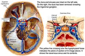 Cavernous Sinus Operative Neurosurgery Sinusitis Anatomy Brain Anatomy