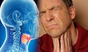 In addition to a lump, swelling or thickness in the neck, some other warning signs and symptoms of throat cancer include: Throat Cancer Symptoms And Signs Are You At Risk Watch Out For A Sore Throat Express Co Uk