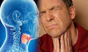 Vomiting blood or black material resembling coffee grounds; Throat Cancer Symptoms And Signs Are You At Risk Watch Out For A Sore Throat Express Co Uk
