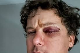 Fundraiser for Janio Axelson by Eric Grady : Help Janio with bills after  brutal mugging