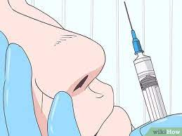Spiders occur in about 50% of people by the time. 4 Ways To Get Rid Of Spider Veins On Your Nose Wikihow
