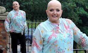 Nolan initially formed the singing nolans alongside tommy and maureen. Linda Nolan 61 Steps Out In Public For The First Time After Sharing Her Devastating Cancer Battle Daily Mail Online